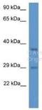 Mediator Complex Subunit 19 antibody, NBP1-79597, Novus Biologicals, Western Blot image 