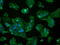 Glutamate-Ammonia Ligase antibody, GTX84426, GeneTex, Immunofluorescence image 