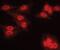 Protein Phosphatase 2 Regulatory Subunit Balpha antibody, PA5-17515, Invitrogen Antibodies, Immunofluorescence image 