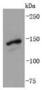 Zinc finger protein GLI1 antibody, A00527-2, Boster Biological Technology, Western Blot image 
