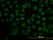 Decapping Enzyme, Scavenger antibody, LS-C133735, Lifespan Biosciences, Immunofluorescence image 