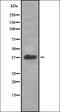 ATP Binding Cassette Subfamily G Member 2 (Junior Blood Group) antibody, orb335294, Biorbyt, Western Blot image 