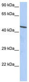 Zinc Finger Protein 830 antibody, TA341435, Origene, Western Blot image 