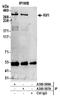 Replication Timing Regulatory Factor 1 antibody, A300-569A, Bethyl Labs, Immunoprecipitation image 