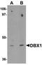 Homeobox protein DBX1 antibody, orb75653, Biorbyt, Western Blot image 