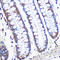Bmk1 antibody, GTX02855, GeneTex, Immunohistochemistry paraffin image 