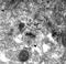 Metabotropic glutamate receptor 1 antibody, 75-116, Antibodies Incorporated, Electron Microscopy image 