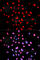 Bruton Tyrosine Kinase antibody, AP0100, ABclonal Technology, Immunofluorescence image 