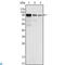 FER Tyrosine Kinase antibody, LS-C812596, Lifespan Biosciences, Immunofluorescence image 