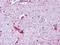 MAS Related GPR Family Member F antibody, NLS1983, Novus Biologicals, Immunohistochemistry paraffin image 