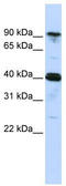 Cysteinyl-tRNA synthetase, cytoplasmic antibody, TA345736, Origene, Western Blot image 
