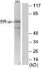 Estrogen Receptor 1 antibody, TA311731, Origene, Western Blot image 