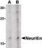 Neuritin 1 antibody, NBP1-03026, Novus Biologicals, Western Blot image 