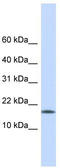 Histone H3-like centromeric protein A antibody, TA338984, Origene, Western Blot image 