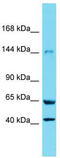 Xanthine Dehydrogenase antibody, TA343291, Origene, Western Blot image 