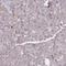 Prolyl endopeptidase antibody, HPA031390, Atlas Antibodies, Immunohistochemistry paraffin image 