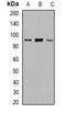 VPS35 Retromer Complex Component antibody, orb382688, Biorbyt, Western Blot image 