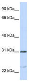 Nucleolar And Spindle Associated Protein 1 antibody, TA339336, Origene, Western Blot image 