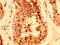 Tankyrase-1 antibody, CSB-PA024004LA01HU, Cusabio, Immunohistochemistry frozen image 