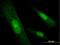 Sex Determining Region Y antibody, H00006736-B01P, Novus Biologicals, Immunofluorescence image 