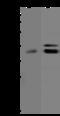 Mitochondrial Fission Regulator 1 antibody, 200486-T36, Sino Biological, Western Blot image 