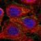 Catenin Delta 1 antibody, HPA015955, Atlas Antibodies, Immunofluorescence image 