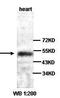 Calponin 3 antibody, orb76999, Biorbyt, Western Blot image 