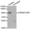 Hdm2 antibody, LS-C335768, Lifespan Biosciences, Western Blot image 