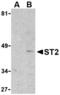 Interleukin 1 Receptor Like 1 antibody, TA306180, Origene, Western Blot image 