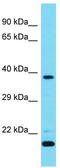 Calcium/Calmodulin Dependent Protein Kinase ID antibody, TA344785, Origene, Western Blot image 