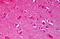 NMDAR2B antibody, MBS246120, MyBioSource, Immunohistochemistry paraffin image 