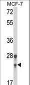 Psf1 antibody, LS-C166478, Lifespan Biosciences, Western Blot image 