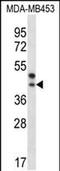 Palmitoyl-Protein Thioesterase 2 antibody, PA5-48700, Invitrogen Antibodies, Western Blot image 