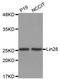 Lin-28 Homolog A antibody, LS-C334475, Lifespan Biosciences, Western Blot image 