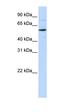 Phosphatidate cytidylyltransferase 1 antibody, orb325206, Biorbyt, Western Blot image 