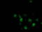 Destrin, Actin Depolymerizing Factor antibody, LS-C172798, Lifespan Biosciences, Immunofluorescence image 