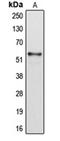 Cytochrome P450 2B6 antibody, orb213820, Biorbyt, Western Blot image 