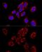 Transcription Elongation Factor, Mitochondrial antibody, GTX64957, GeneTex, Immunocytochemistry image 