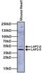 Lamina-associated polypeptide 2, isoforms beta/gamma antibody, MA1-075, Invitrogen Antibodies, Western Blot image 