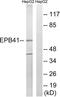 Erythrocyte Membrane Protein Band 4.1 antibody, LS-C118357, Lifespan Biosciences, Western Blot image 