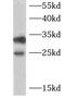 Charged multivesicular body protein 1a antibody, FNab01656, FineTest, Western Blot image 
