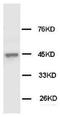 Keratin 18 antibody, AM20608PU-N, Origene, Western Blot image 