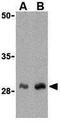 C1q And TNF Related 1 antibody, GTX85079, GeneTex, Western Blot image 