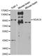 Histone Deacetylase 9 antibody, A1516, ABclonal Technology, Western Blot image 
