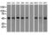 Keratin 8 antibody, LS-C114318, Lifespan Biosciences, Western Blot image 