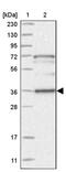 Sushi Domain Containing 6 antibody, PA5-56481, Invitrogen Antibodies, Western Blot image 