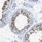 Dynein Axonemal Intermediate Chain 1 antibody, NBP1-84465, Novus Biologicals, Immunohistochemistry frozen image 