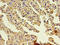 Gelsolin antibody, A50273-100, Epigentek, Immunohistochemistry paraffin image 