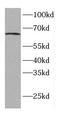 Chromatin Licensing And DNA Replication Factor 1 antibody, FNab01571, FineTest, Western Blot image 