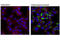 Microtubule Associated Protein 1 Light Chain 3 Beta antibody, 3868S, Cell Signaling Technology, Immunofluorescence image 
